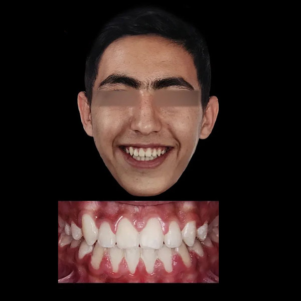 after2