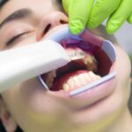 ارتودنسی فانکشنال یا عملکردی چیست و با ارتودنسی معمولی چه تفاوتی دارد