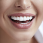 درباره مراحل ارتودنسی و مدت زمان درمان آن چه میدانید؟