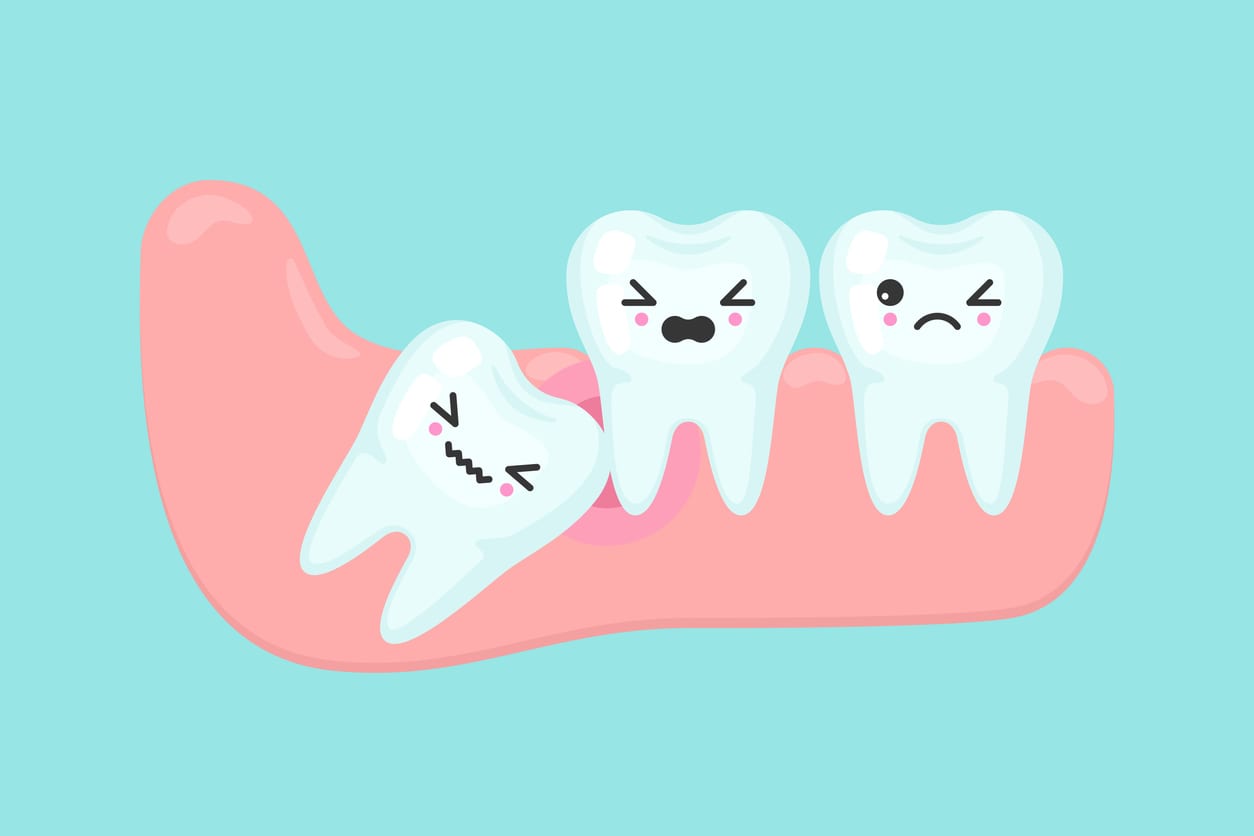 Wisdom tooth problems dental stomatology vector concept