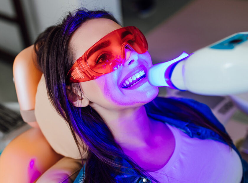 Teeth whitening for woman. Bleaching of the teeth at modern dent