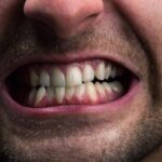 دندان قروچه چیست؟