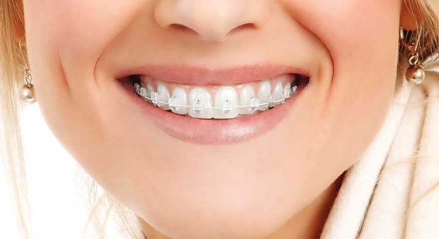 ارتودنسی چکار می کند