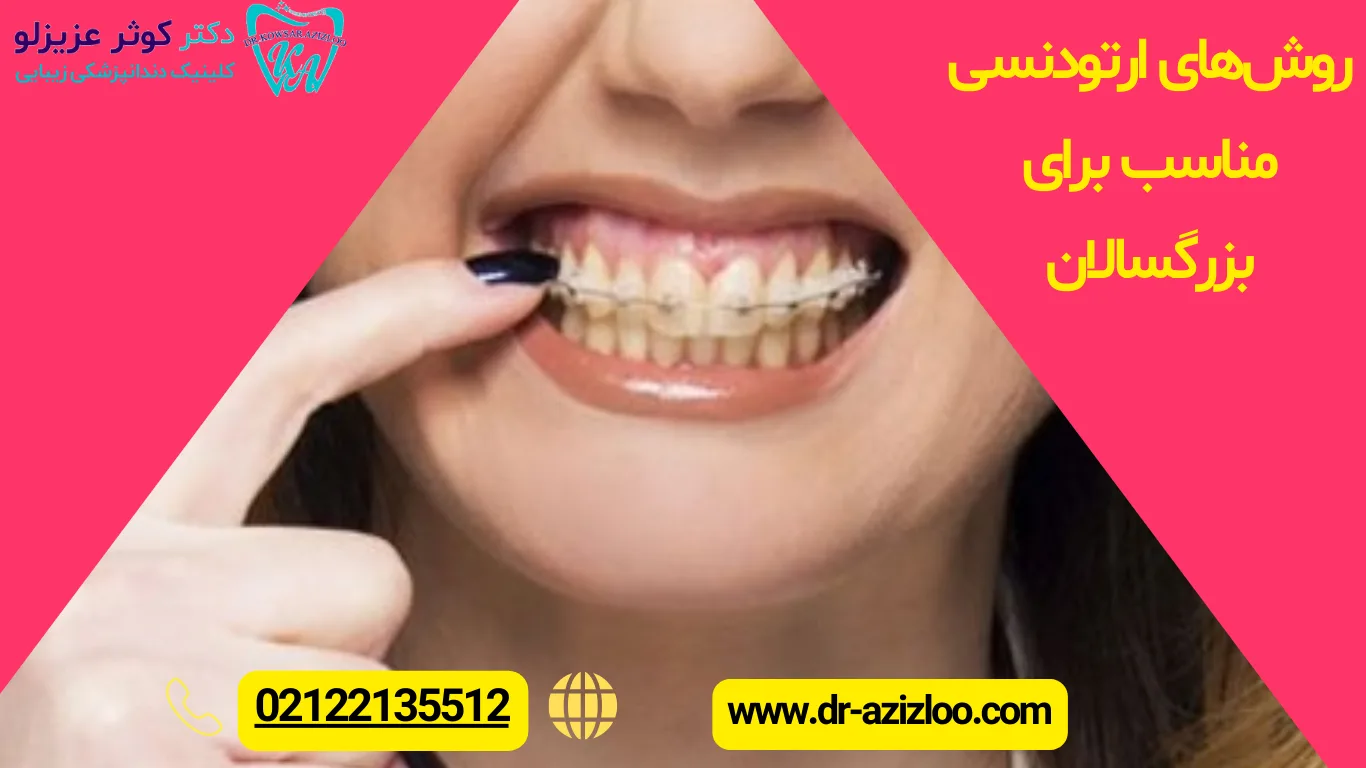 روش‌های ارتودنسی مناسب برای بزرگسالان