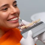 مراقبت بعد از لمینت و کامپوزیت؛ چه کارهایی را باید تا مدتی محدود کنیم؟